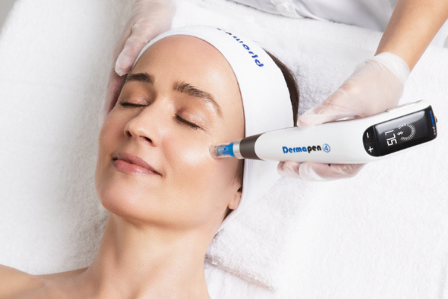 Microneedling behandeling bij Apotheek&Beauty Monster