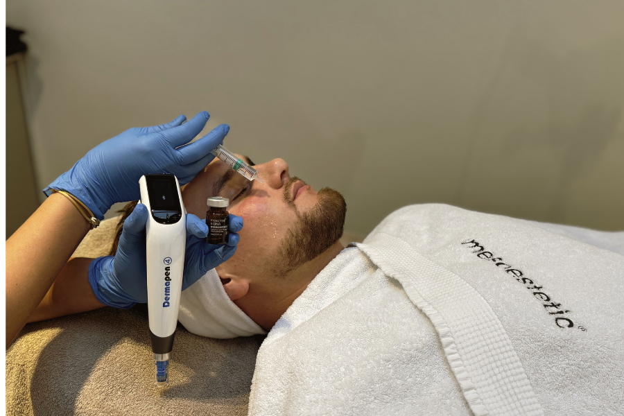 Laserbehandeling gezicht bij Apotheek&Beauty Monster