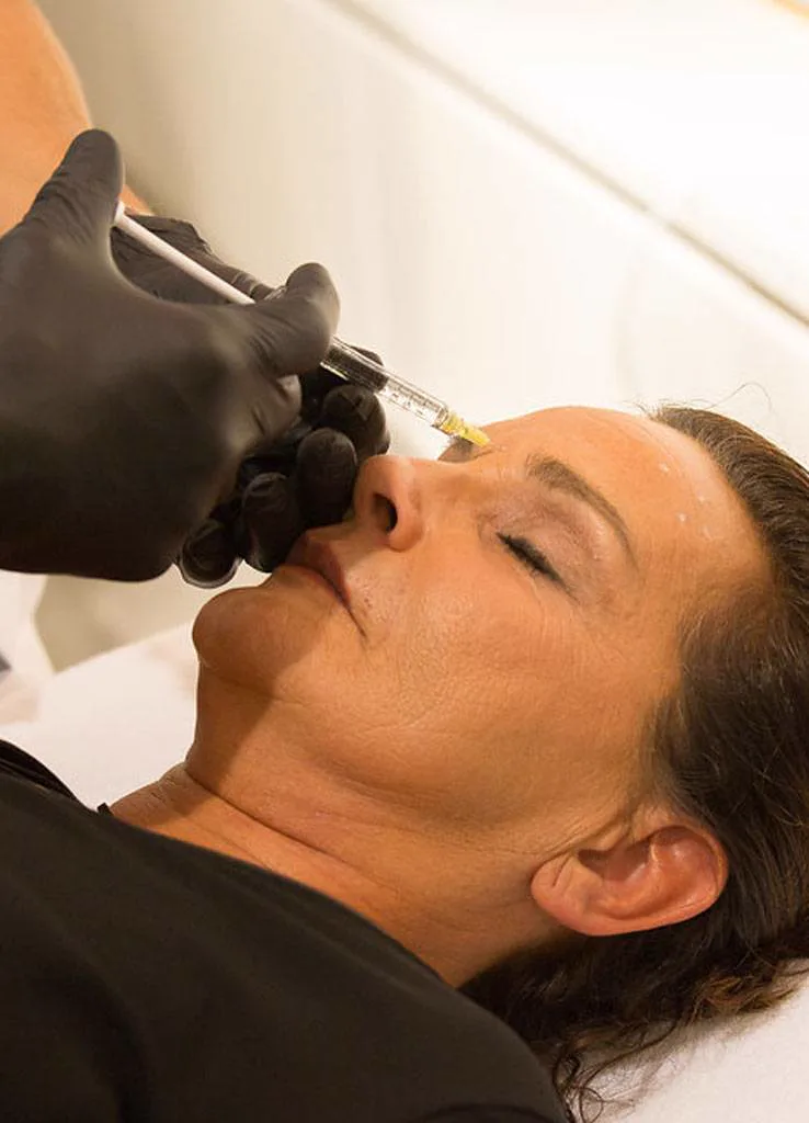 Botox behandeling bij Apotheek&Beauty Monster