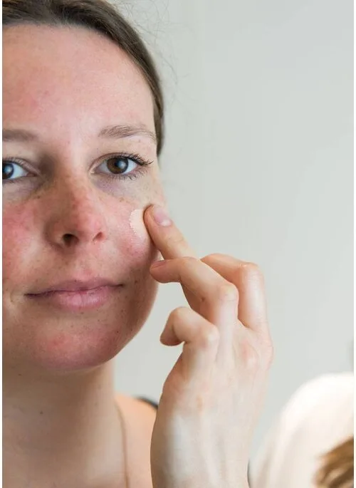 Camouflagetherapie bij Apotheek&Beauty Monster