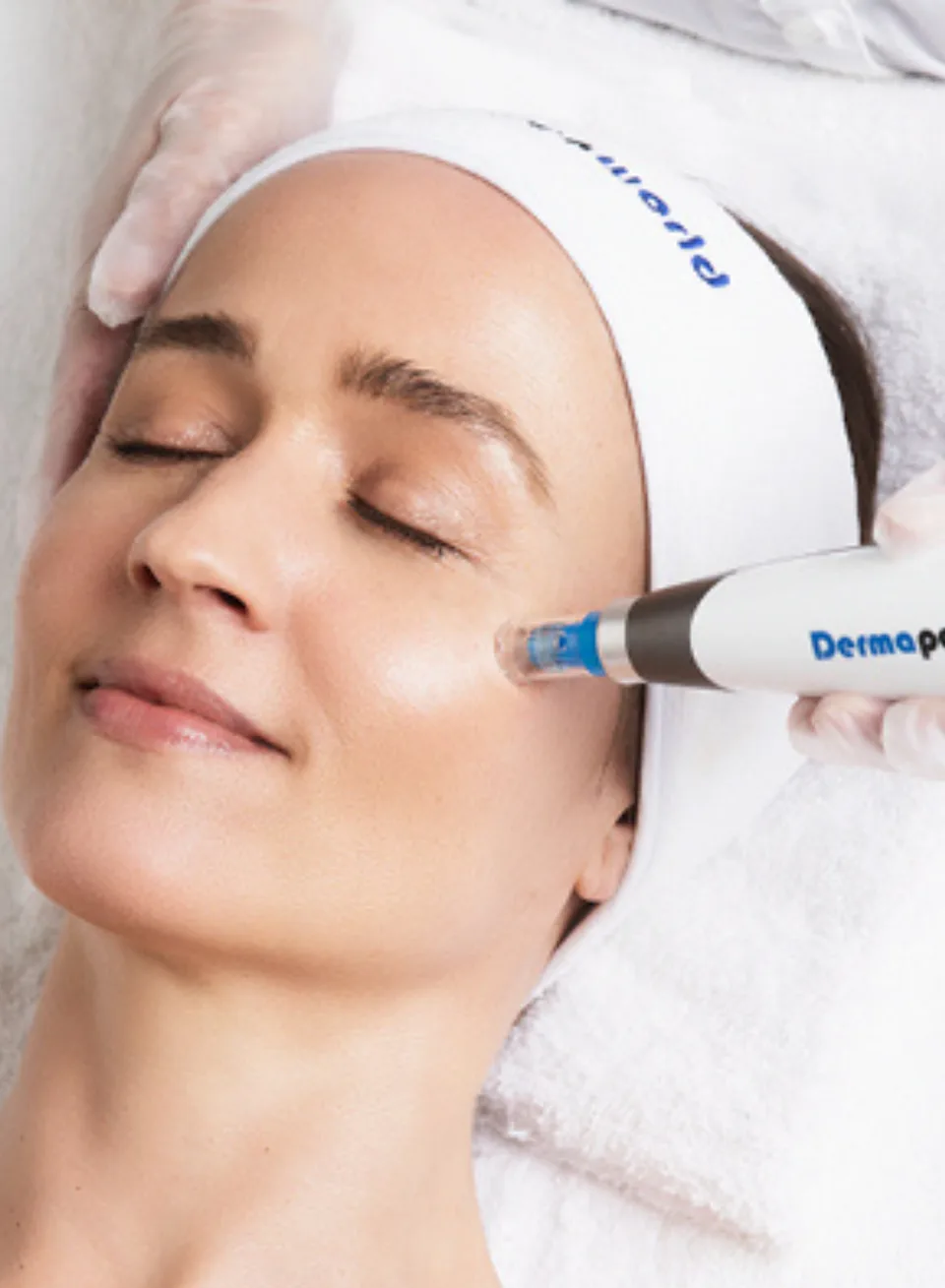 Dermapen4 Microneedling behandeling bij Apotheek&Beauty Monster