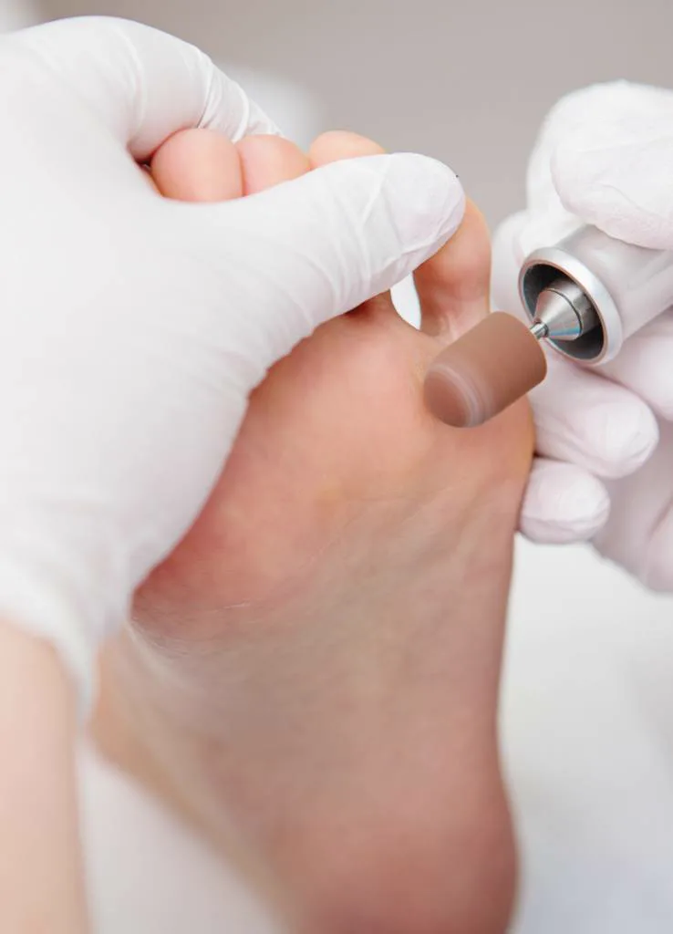 Deelbehandeling pedicure bij Apotheek&Beauty Monster