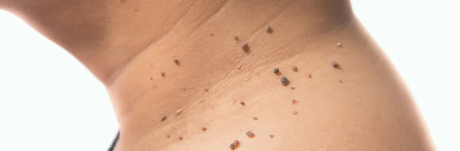 Fibromen bij Apotheek&Beauty Monster